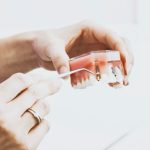 Tout sur les mini-implants dentaires